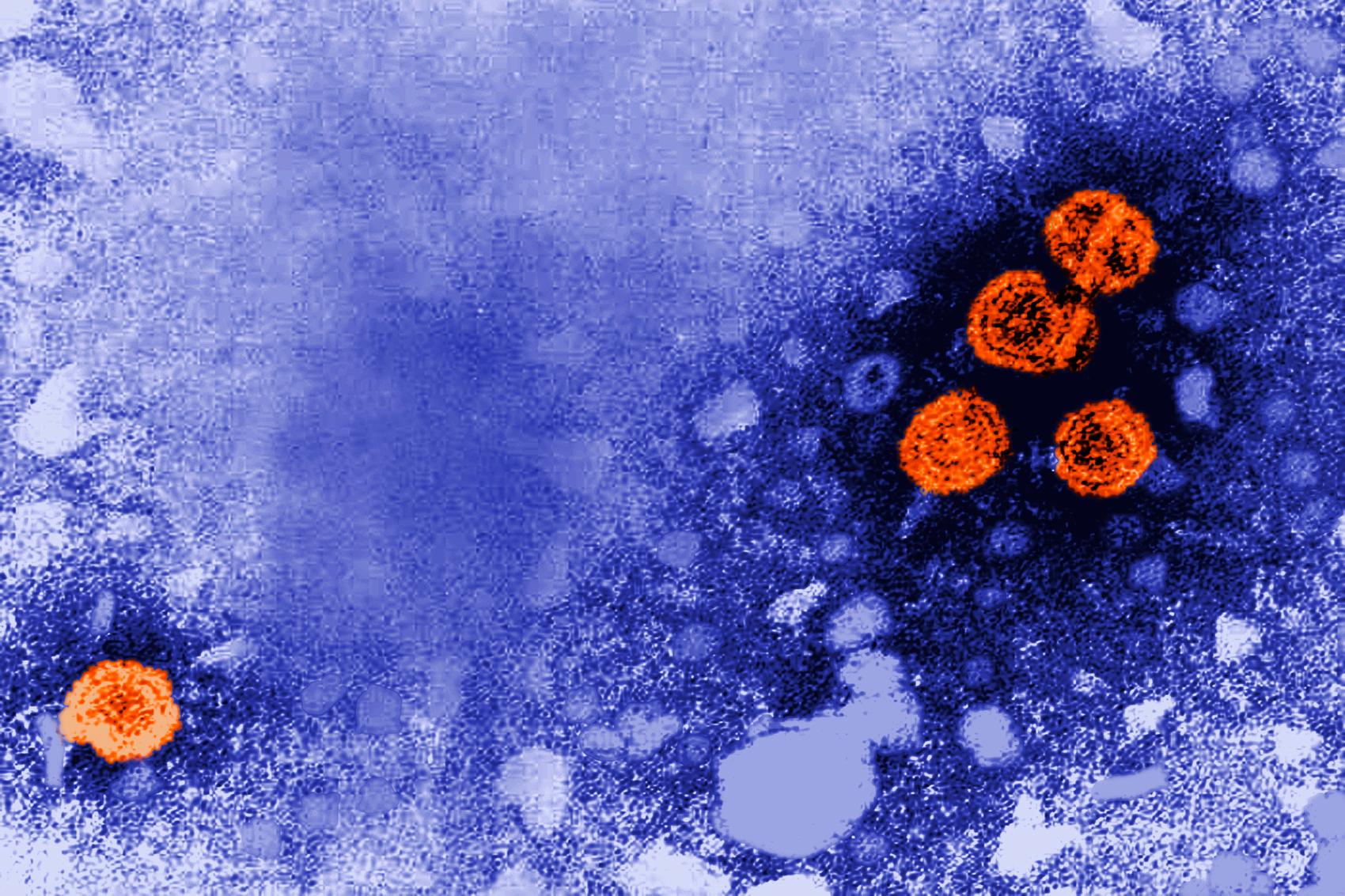 Experimental hepatitis B drug might offer 'functional cure' for a subset of patients